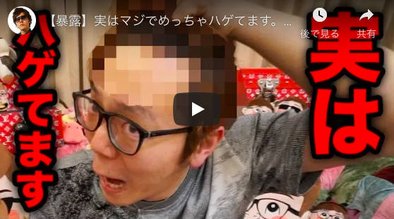 ダルビッシュ有「心強い仲間がいた」 ヒカキンの「薄毛告白」動画に共感